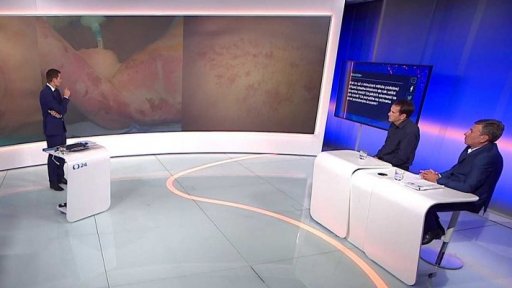 Zdravotní rizika při zásahu bleskem - Robert Zajíček, Jiří Kutáč a Pavel Antl