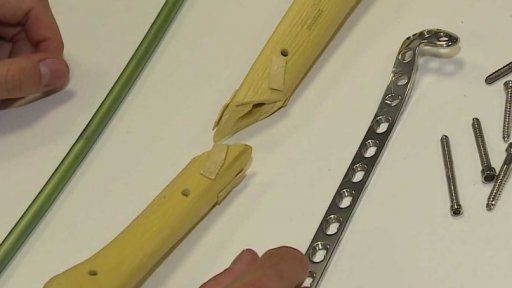 Speciální lepidlo na zlomené kosti