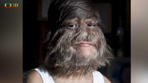 Příroda: Lykantropie aneb existují vlkodlaci?