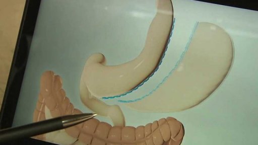 Nadváha a obezita v ČR