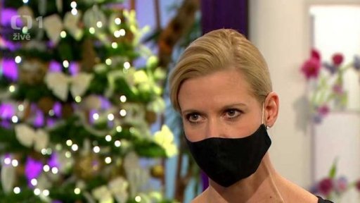 Unikátní operace - prenatální - nádor na kostrči - 3. část