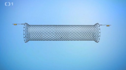 Stenty firmy ELLA-CS