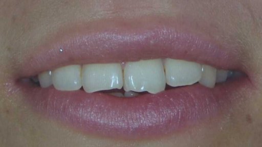 Novela o zdravotním pojištění