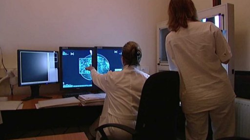 Onkologická prevence