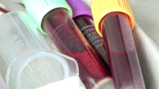 První lék na Alzheimerovu chorobu