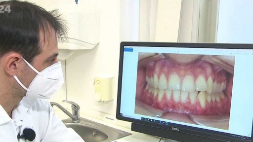 Příspěvky na rovnátka