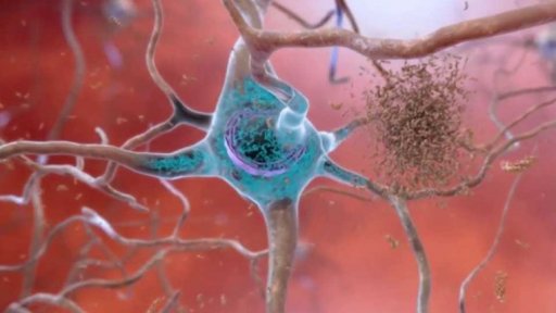 Lék na Alzheimerovu chorobu