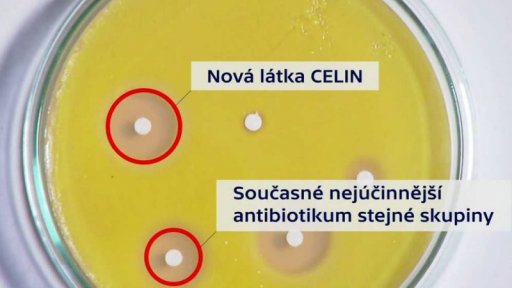 Odolnost bakterií vůči antibiotikům