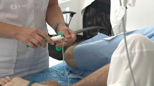 Prevence rakoviny tlustého střeva