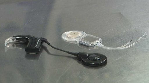 Sluchový kmenový implantát