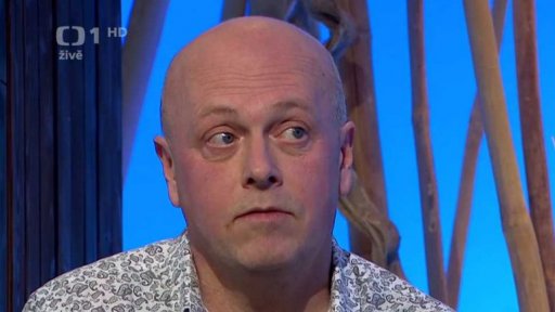 Močové kameny - 2. část