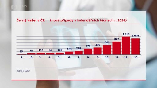 Šíření černého kašle v Česku