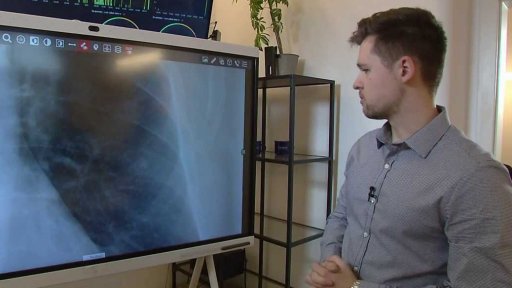 Umělá inteligence pomáhající lékařům