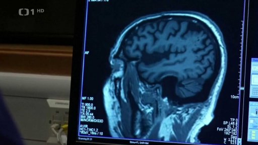 Nový lék na Alzheimerovu chorobu