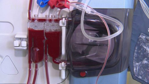 Výzkum vzácné Fabryho choroby