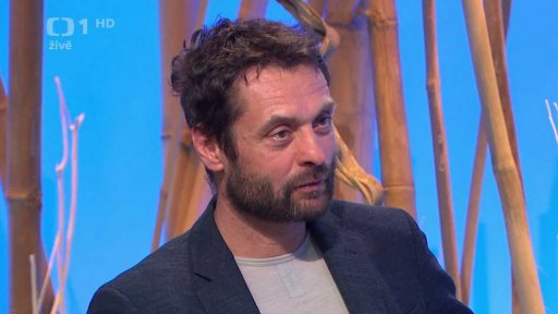 Endometrióza - 2. část