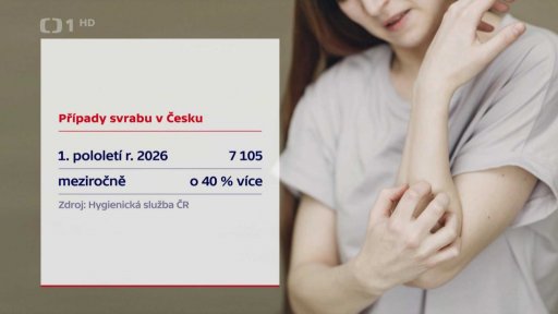 Případy svrabu v Česku