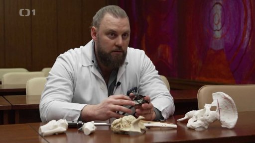 3D tisk implantátů kostí