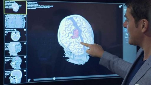 Pokrok zobrazovacích technologií a jejich pomoc chirurgům