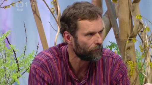 Intervenční kardiologie - 1. část