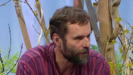 Intervenční kardiologie - 2. část