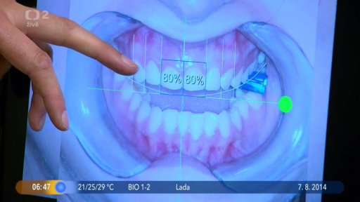Beseda: Estetická stomatologie + Soutěž