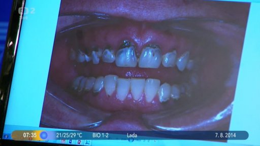 Beseda: Estetická stomatologie + Soutěž