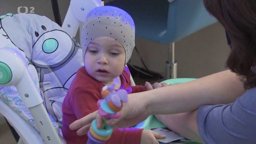 ČT Ostrava: Kraniosynostóza