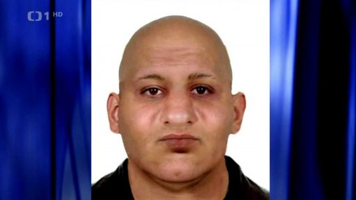 Otevřená zlomenina čelisti