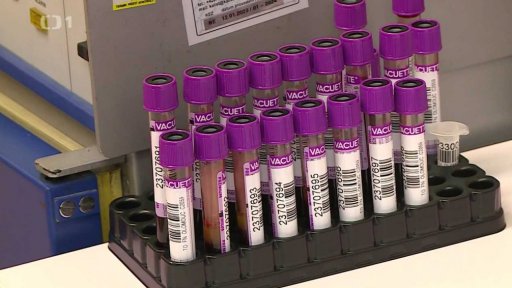 Nedostatek krve ve FN Olomouc