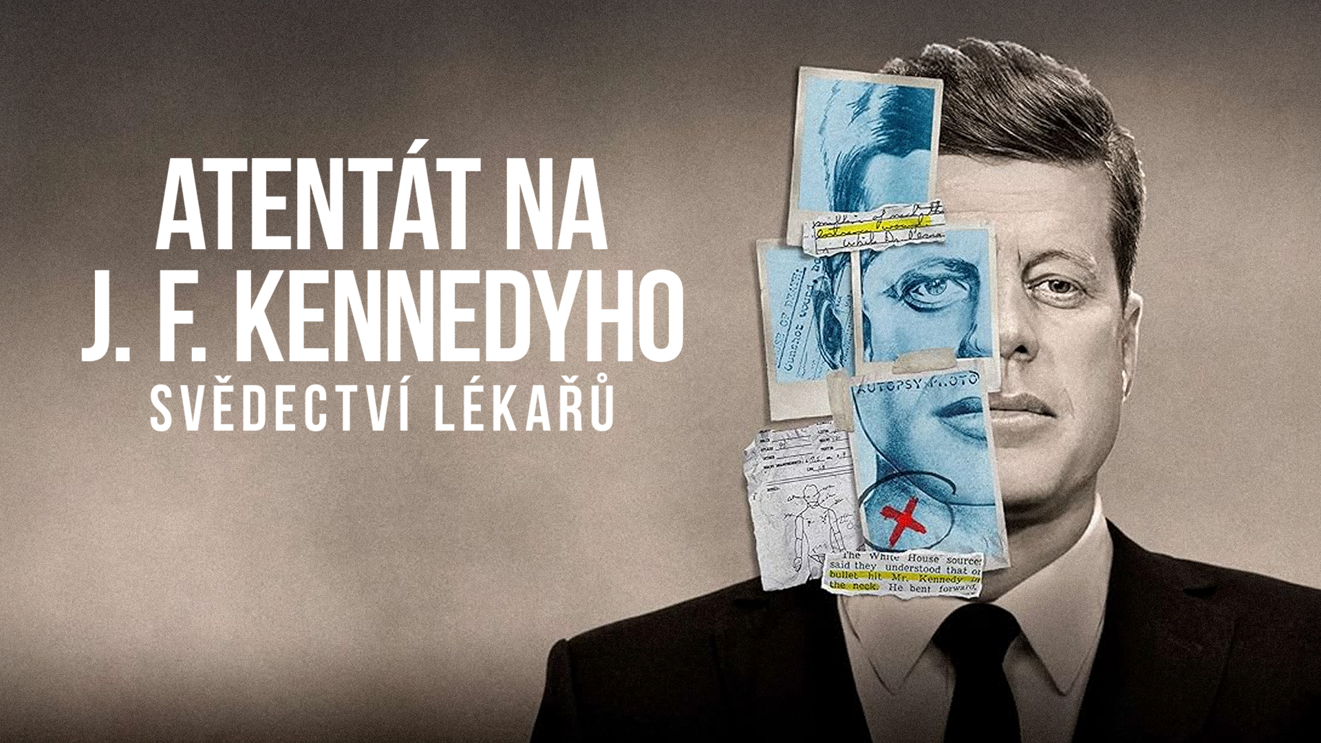 Atentát na J. F. Kennedyho: Svědectví lékařů